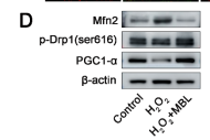 Phospho-DRP1 (Ser616) Antibody - Fig.