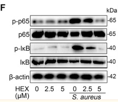 NF-kB p65 Antibody - Fig 3 HEX enhances barrier integrity and limits the NF-κB signaling pathway in MMECs.