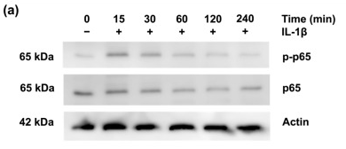 NF-kB p65 Antibody - Figure 4 Effects of AdipoRon on p65 and adenosine monophosphate-activated protein kinase (AMPK) phosphorylation under proinflammatory conditions.
