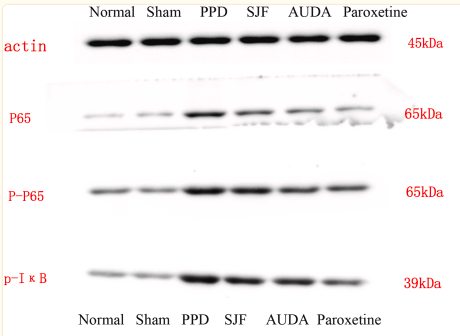 NF-kB p65 Antibody - Fig.
