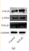 GAPDH Antibody - Figure 2 Overexpression of COL28 promotes EMT in HK-2 cells.