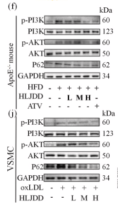 SQSTM1/p62 Antibody - Fig.