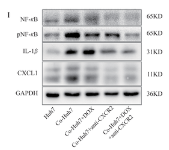 IL1 beta Antibody - Figure 1.
