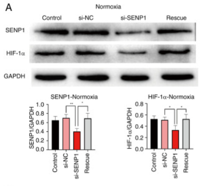 HIF1A Antibody - Figure 4.