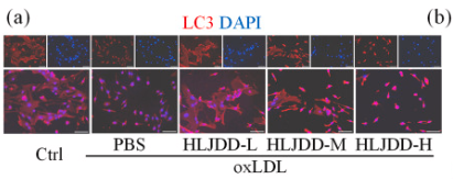 LC3A/B Antibody - Fig.
