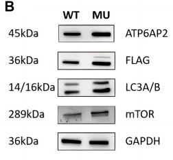 mTOR Antibody - FIGURE 3 Expression of ATP6AP2, FLAG, LC3A/B and mTOR in HEK293T cells harboring wild type and mutant.