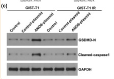 Cleaved-Caspase 1 (Asp296), p20 Antibody - Figure 5 Effects of ANO6 (TMEM16F) on GIST-T1 and GIST-T1 IR cell pyroptosis.