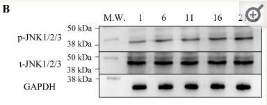 Phospho-JNK1/2/3 (Thr183+Tyr185) Antibody - Figure 8 The phosphorylation of ERK1/2 and JNK1/2/3 as the key component of the MAPK family under different oxygen concentrations.
