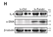 IL6 Antibody - Figure 5 Hepatocyte Fendrr promotes the activation of HSC in a paracrine manner through enhancing IL-6 expression.