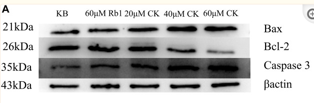 Bcl-2 Antibody - FIGURE 5 Effects of Ginsenoside Rb1 and Ginsenoside CK on Apoptosis-related Proteins in HGC-27 (A) Apoptosis-related proteins Bax, Bcl-2, Caspase 3 bands.