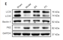 Beclin 1 Antibody - Figure 7 BA inhibits apoptosis and oxidative stress and promotes autophagy in the spinal cord tissue of SCI rats.