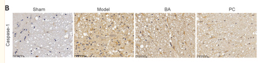 Caspase 1 Antibody - Figure 5 BA suppresses pyroptosis and promotes anti-oxidation in the spinal cord of SCI rats.