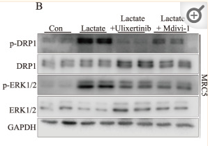 ERK1/2 Antibody - Fig.