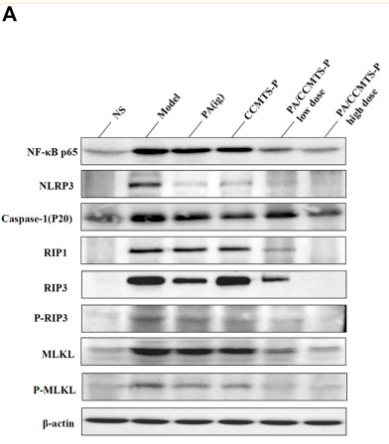 beta Actin Antibody - FIGURE 7 PA/CCMTS-P attenuates DSS-induced UC by modulating RIP1/RIP3/MLKL signaling mediated necroptosis and the activation of the NLRP3 inflammasome.