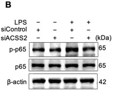 NF-kB p65 Antibody - Fig.