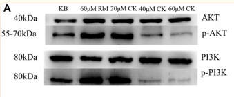 Phospho-AKT1/2/3 (Ser473) Antibody - FIGURE 6 Effects of Ginsenoside Rb1 and Ginsenoside CK on Apoptosis-related Pathways Proteins in HGC-27 (A) Apoptosis-related pathways PI3K, p-PI3K, AKT, p-AKT bands.