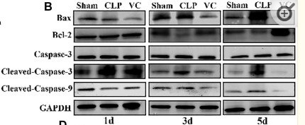 Cleaved-Caspase 9 (Asp353) Antibody - Figure 3 High-dose VC suppressed the cardiomyocyte apoptosis in CLP-induced sepsis rats at 1d, 3d and 5d.