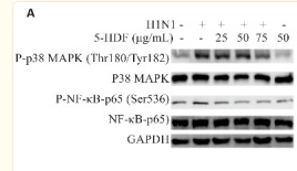 GAPDH Antibody - 图4 不同浓度的5-HDF处理24 h后A549细胞内P-p38 MAPK(Thr180/Tyr182)、P-NF-κB-p65(Ser536)蛋白水平和IL-8炎症因子水平变化 Fig.