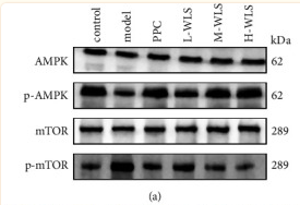 AMPK alpha Antibody - Figure 6 Effect of WLS on regulating the AMPK/mTOR/ULK1 signaling pathway in MAFLD rats.