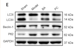 SQSTM1/p62 Antibody - Figure 7 BA inhibits apoptosis and oxidative stress and promotes autophagy in the spinal cord tissue of SCI rats.