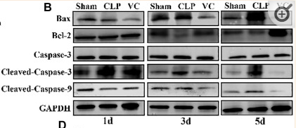 Bcl-2 Antibody - Figure 3 High-dose VC suppressed the cardiomyocyte apoptosis in CLP-induced sepsis rats at 1d, 3d and 5d.