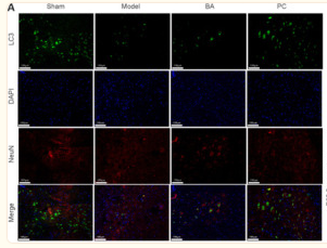 LC3A/B Antibody - Figure 4 On day 21 after injury, the promoting effect of BA on neuronal autophagy in the spinal cord tissue of SCI rats was observed.