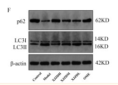 SQSTM1/p62 Antibody - Figure 5.