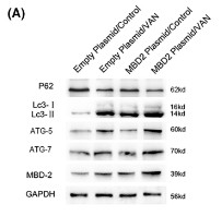 GAPDH Antibody - FIGURE 3 MBD2-mediated VAN induced the expression of S1pr1, p62, LC3I/II in HK-2 cells.