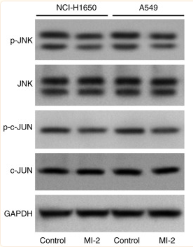 Phospho-JNK1/2/3 (Thr183+Tyr185) Antibody - Figure 5.
