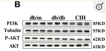 PI3K p85 alpha Antibody - Fig 2 Effects of CIH exposure on the insulin-signaling pathway of male db/db mice at 12 to 13 weeks.