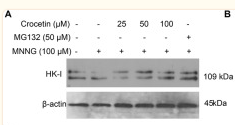 Hexokinase 1 Antibody - Fig.