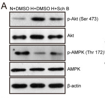 AMPK alpha Antibody - Figure 7 PI3K/Akt pathway inhibition and AMPK pathway activation are involved in the schisandrin B-induced increase in KCP expression in high glucose-treated HK2 cells.