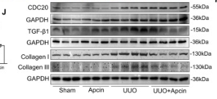TGF beta 1 Antibody - Fig.