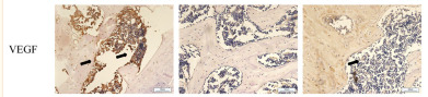 VEGFA Antibody - FIGURE 4 In (A), the immunohistochemical results of Piezo1, RUNX2, BMP2, CD31, HIF-a, and VEGF are presented.