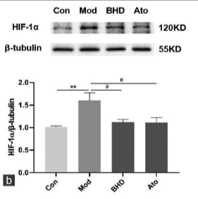 HIF1A Antibody - Figure 5: BHD inhibited protein and mRNA expression of pyruvate kinase M2 (PKM2) and hypoxia-inducible factor-1 alpha (HIF-1α) as well as its target genes (GLUT1, PDK1, lactate dehydrogenase A [LDHA]) in aortas after high fat diet treatment.