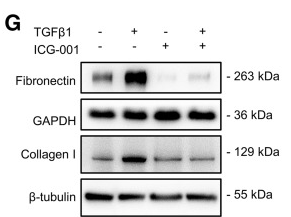 Collagen I Antibody - Figure 3 ICG-001 suppresses TGFβ1-induced extracellular matrix (ECM) proteins production.