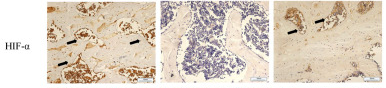 HIF1A Antibody - FIGURE 4 In (A), the immunohistochemical results of Piezo1, RUNX2, BMP2, CD31, HIF-a, and VEGF are presented.