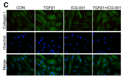 Collagen I Antibody - Figure 3 ICG-001 suppresses TGFβ1-induced extracellular matrix (ECM) proteins production.