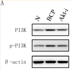 PI3K p85 alpha Antibody - Figure 6 (A)、(C)、(E) Western blotting to detect the expression of PI3K, p-PI3K, Akt, p-Akt, WNK1 and p-WNK1 protein.