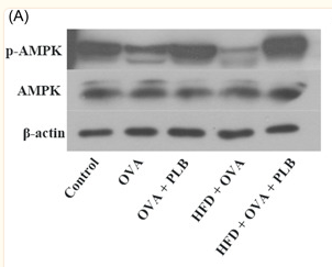 AMPK alpha Antibody - Figure 6 Effects of PLB on the AMPK pathway in the lung tissues of nonobese and obese asthmatic mice.