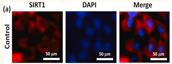 SirT1 Antibody - Figure 6 Combination therapy activates SIRT1 in HepG2 cells and liver of perimenopausal rats.