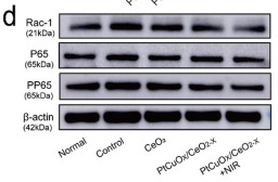 NF-kB p65 Antibody - Fig.