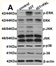 ERK1/2 Antibody - Fig.