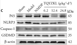 GSDMD Antibody - Figure 3.