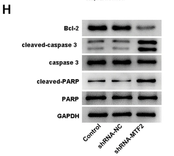 Cleaved-PARP (Asp214) Antibody - Fig.