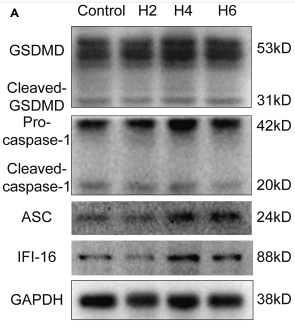GSDMD Antibody - Figure 1.
