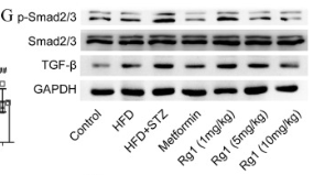 TGF beta 1 Antibody - Fig.