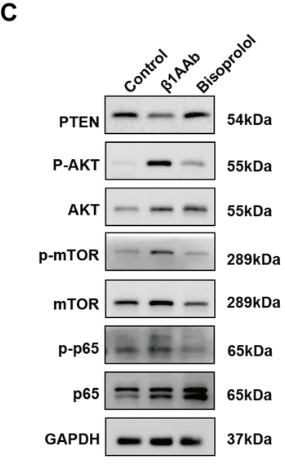 NF-kB p65 Antibody - Figure 4.