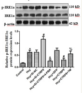 Phospho-IRE1 (Ser724) Antibody - Figure 4.