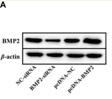 BMP2 Antibody - FIGURE 4.